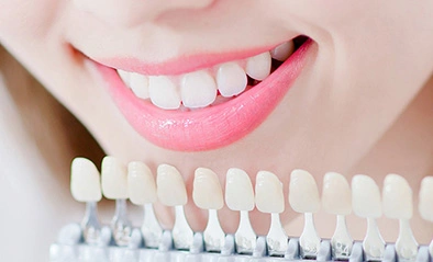 ホワイトニング